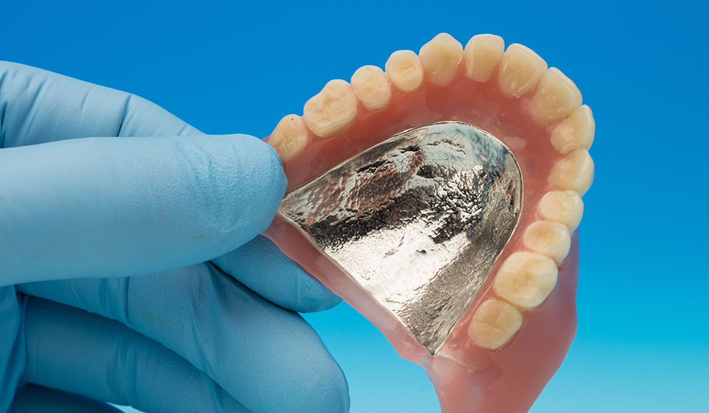 金属床義歯の特長