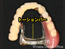 当院のご提案(3)