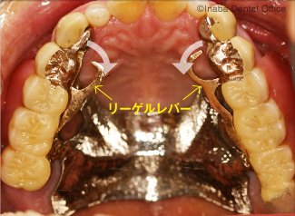 リーゲルレバーを開いた状態