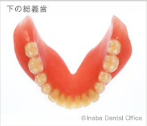シュトラックデンチャー