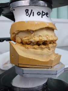 P1030362
